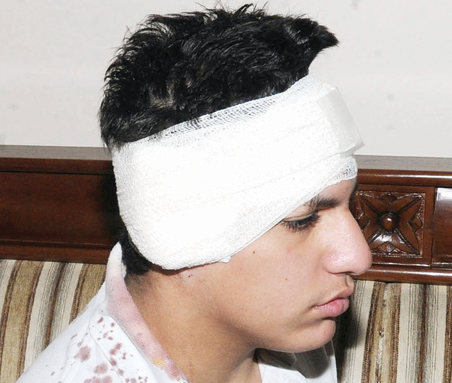 u0627u0644u0637u0627u0644u0628 u0628u0639u062f u0625u0635u0627u0628u062au0647 (u062au0635u0648u064au0631 u0643u0631u0645 u0630u064au0627u0628)