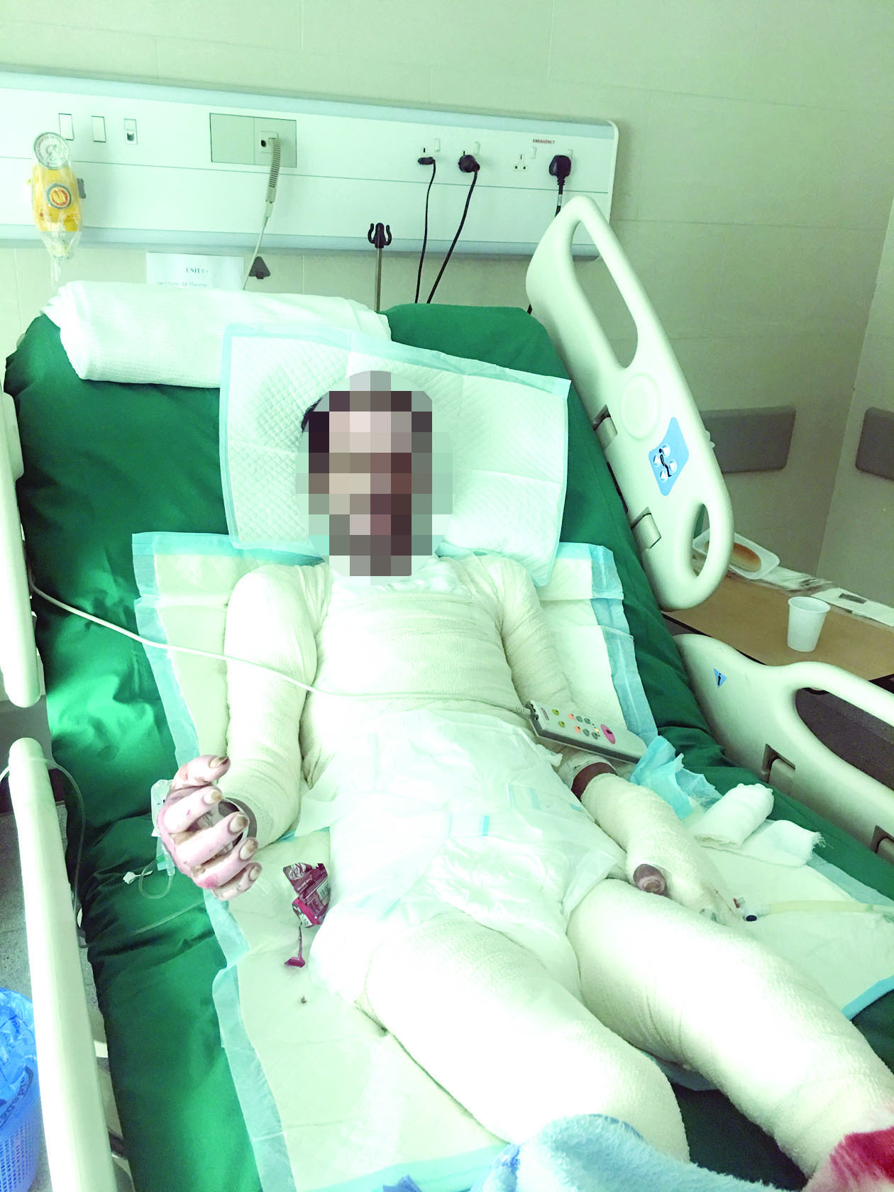 u0639u0627u062fu0644 u0634u0627u0643u0631 u0637u0631u064au062d u0627u0644u0641u0631u0627u0634 u0641u064a u0645u0633u062au0634u0641u0649 u0627u0644u0628u0627u0628u0637u064au0646