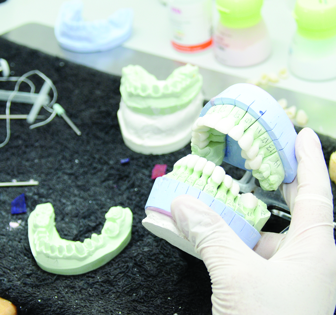 اختيار لون الأسنان... مسألة ذوق