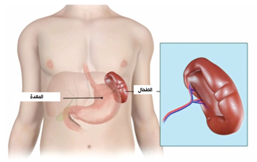 الطحال... بين «التَضَخُّم» و«التوحُّش» - الراي