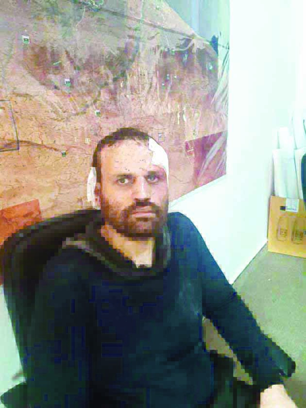 u0647u0634u0627u0645 u0639u0634u0645u0627u0648u064a u0628u0639u062f u062au0648u0642u064au0641u0629 u0641u064a u062fu0631u0646u0629