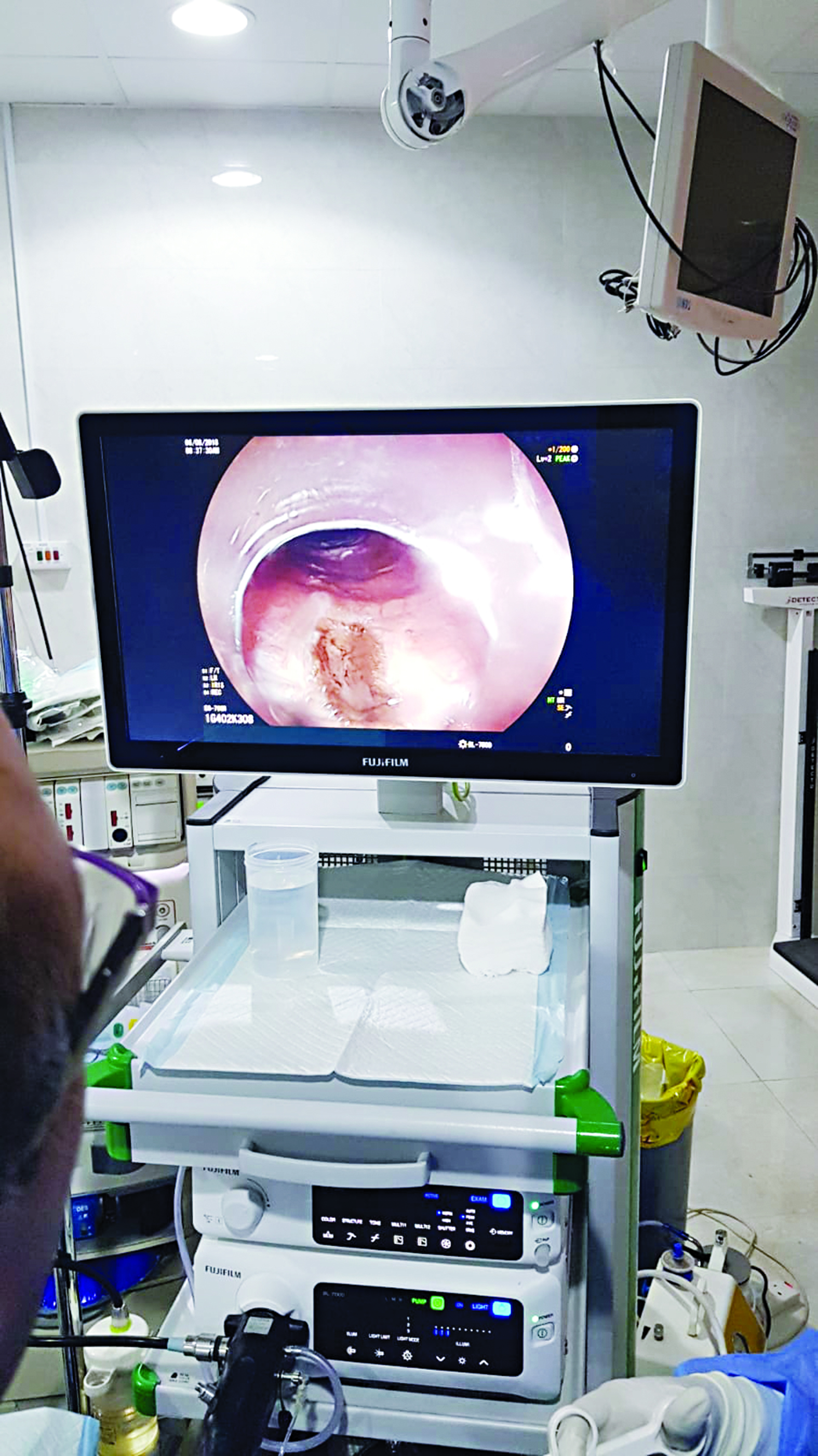 جانب من عملية poem