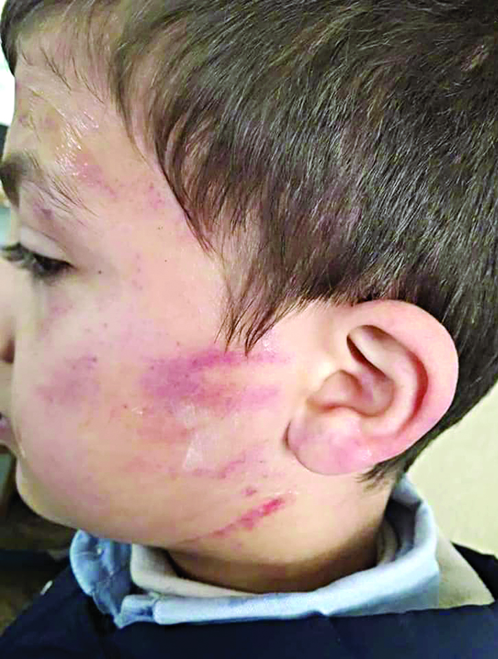 u0622u062bu0627u0631 u0627u0644u0639u0646u0641 u0639u0644u0649 u0648u062cu0647 u0627u0644u0637u0641u0644