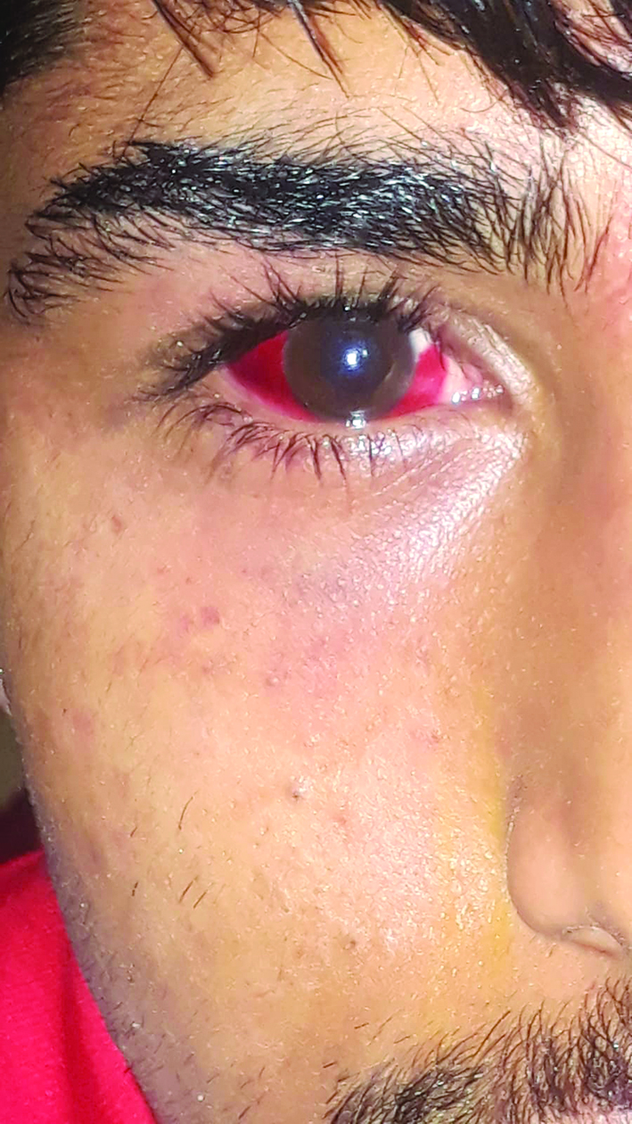 u0622u062bu0627u0631 u0627u0644u0627u0639u062au062fu0627u0621 u0639u0644u0649 u0648u062cu0647 u0623u062du0645u062f