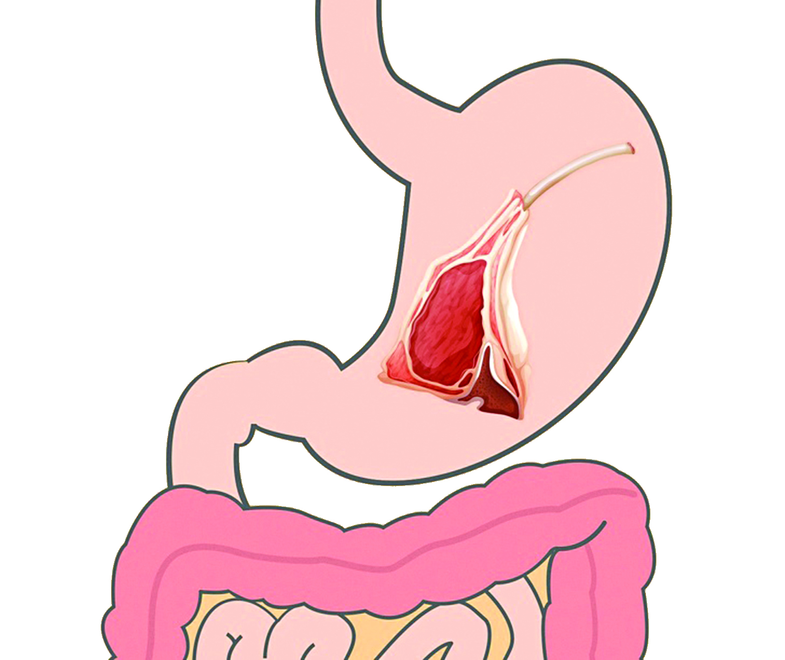 لحوم  الأغنام الضأن   (4 ساعات)