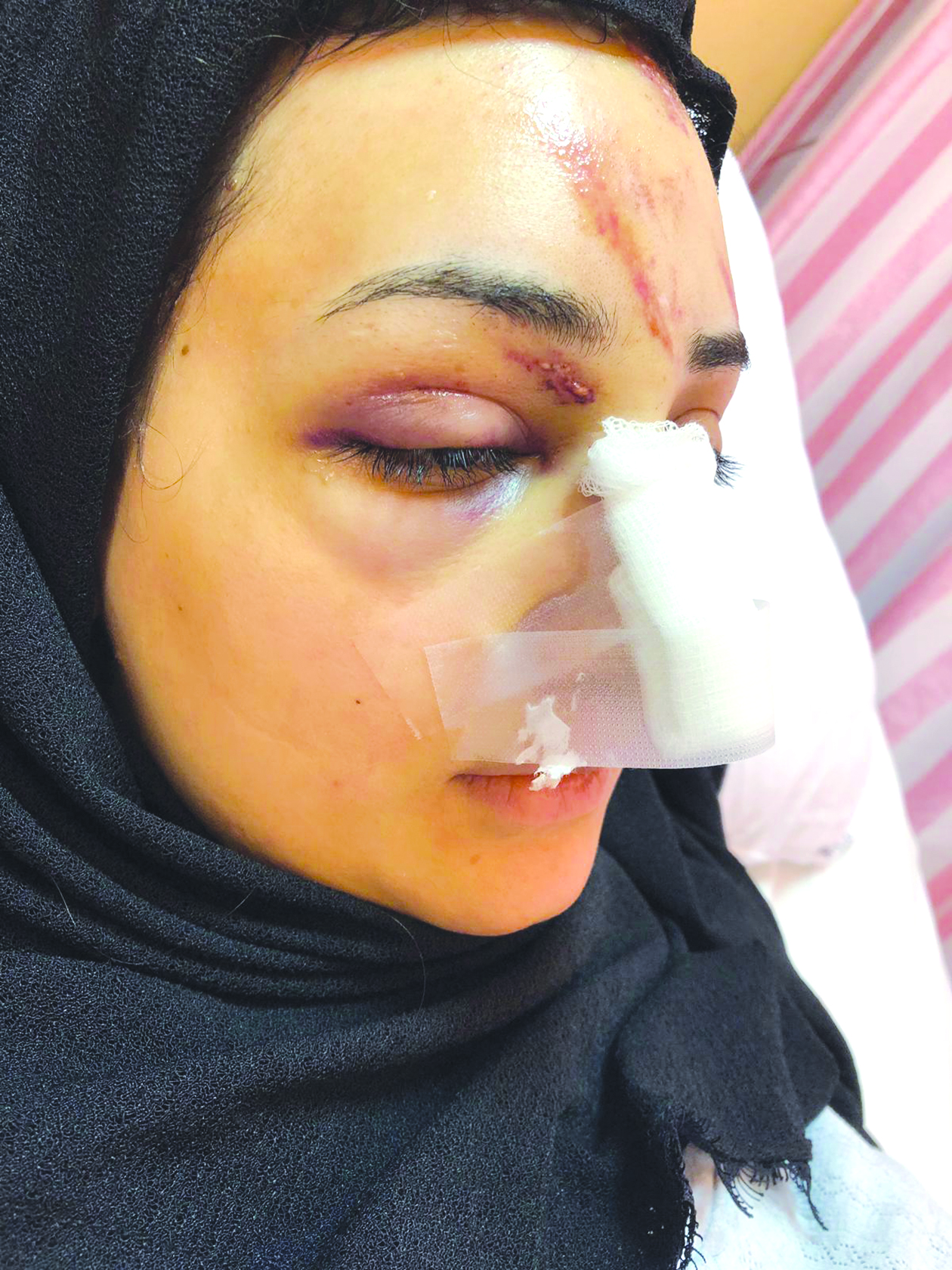 u0627u0644u0641u0644u0633u0637u064au0646u064au0629 u0628u0639u062f u0625u0635u0627u0628u062au0647u0627