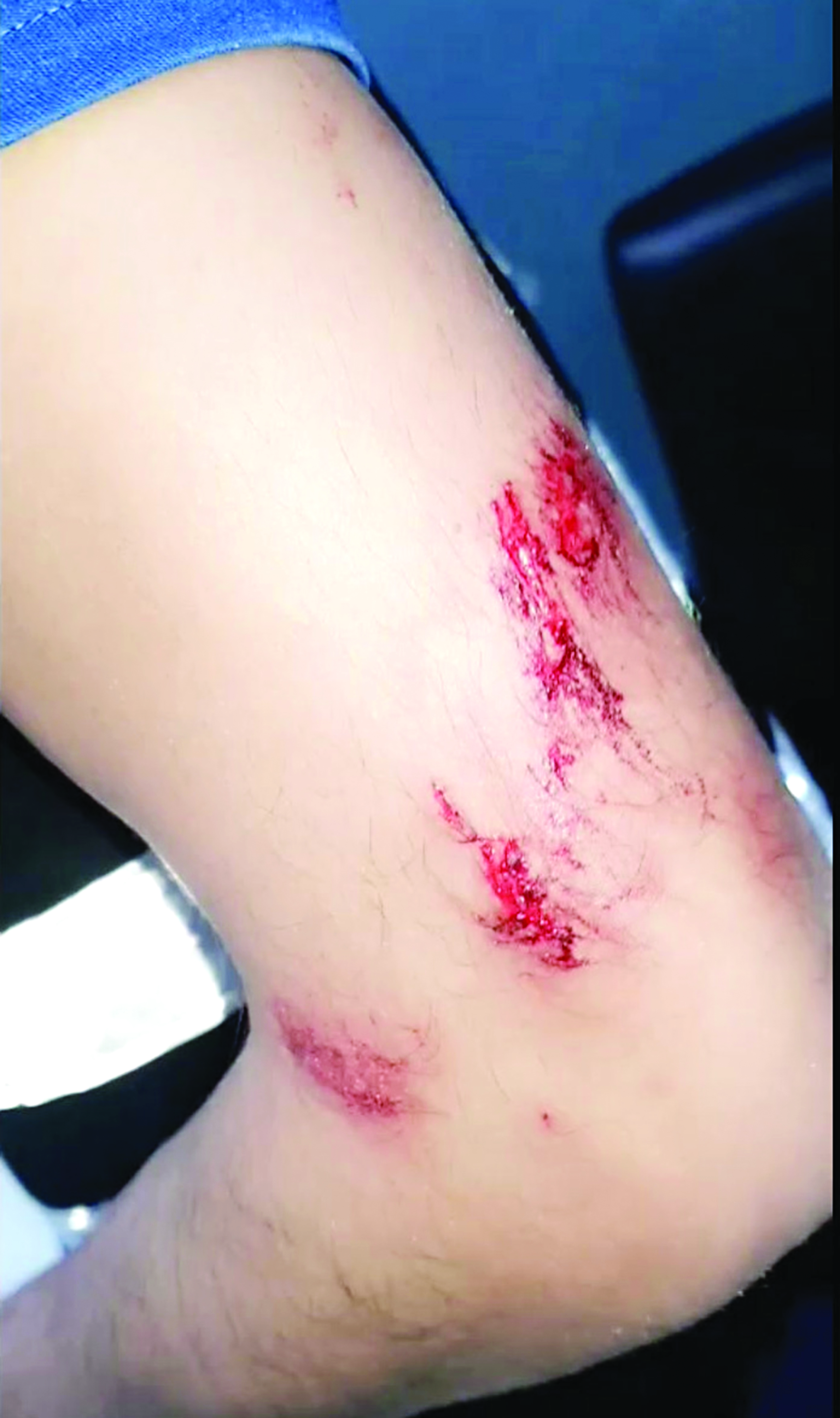 u0622u062bu0627u0631 u0627u0644u0627u0639u062au062fu0627u0621 u0639u0644u0649 u0630u0631u0627u0639 u0623u062du062f u0627u0644u0645u0648u0638u0641u064au0646