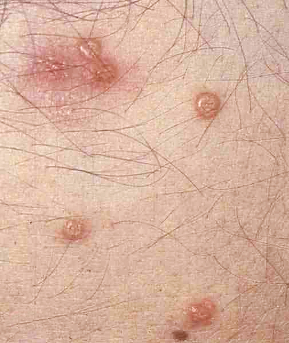 u0639u0644u0627u0645u0627u062a u0627u0644u0645u0631u0636