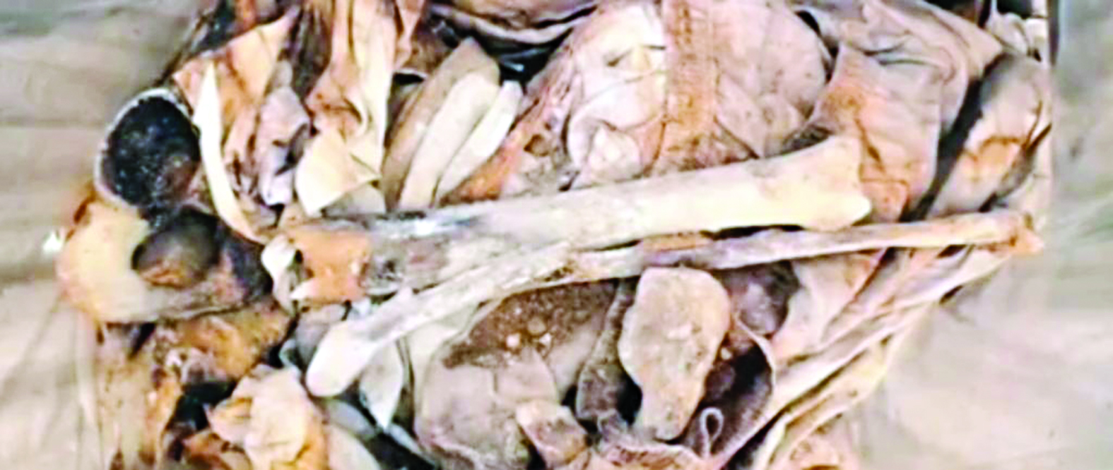 u0645u062cu0645u0648u0639u0629 u0639u0638u0627u0645 u0628u064au0646 u0627u0644u0631u0641u0627u062at(u00abu0627u0644u0631u0627u064au00bb - u062eu0627u0635) 