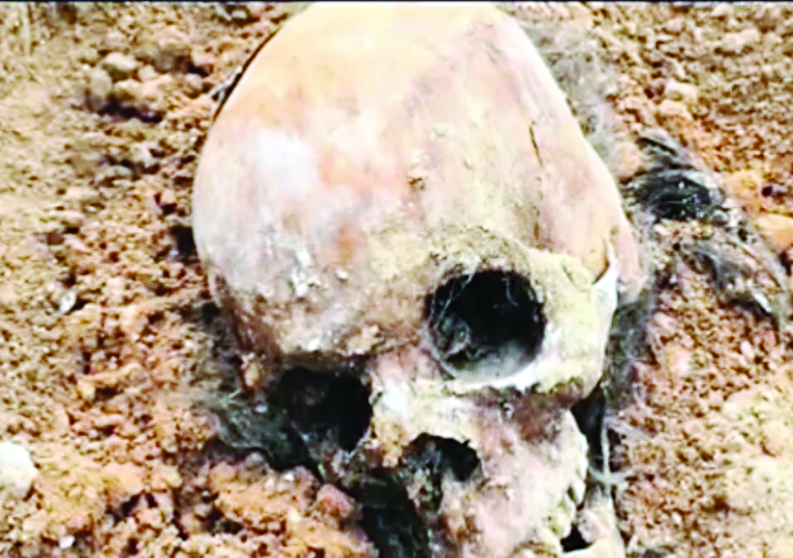 جمجمة بين الرفات المكتشفة 	(«الراي» - خاص)