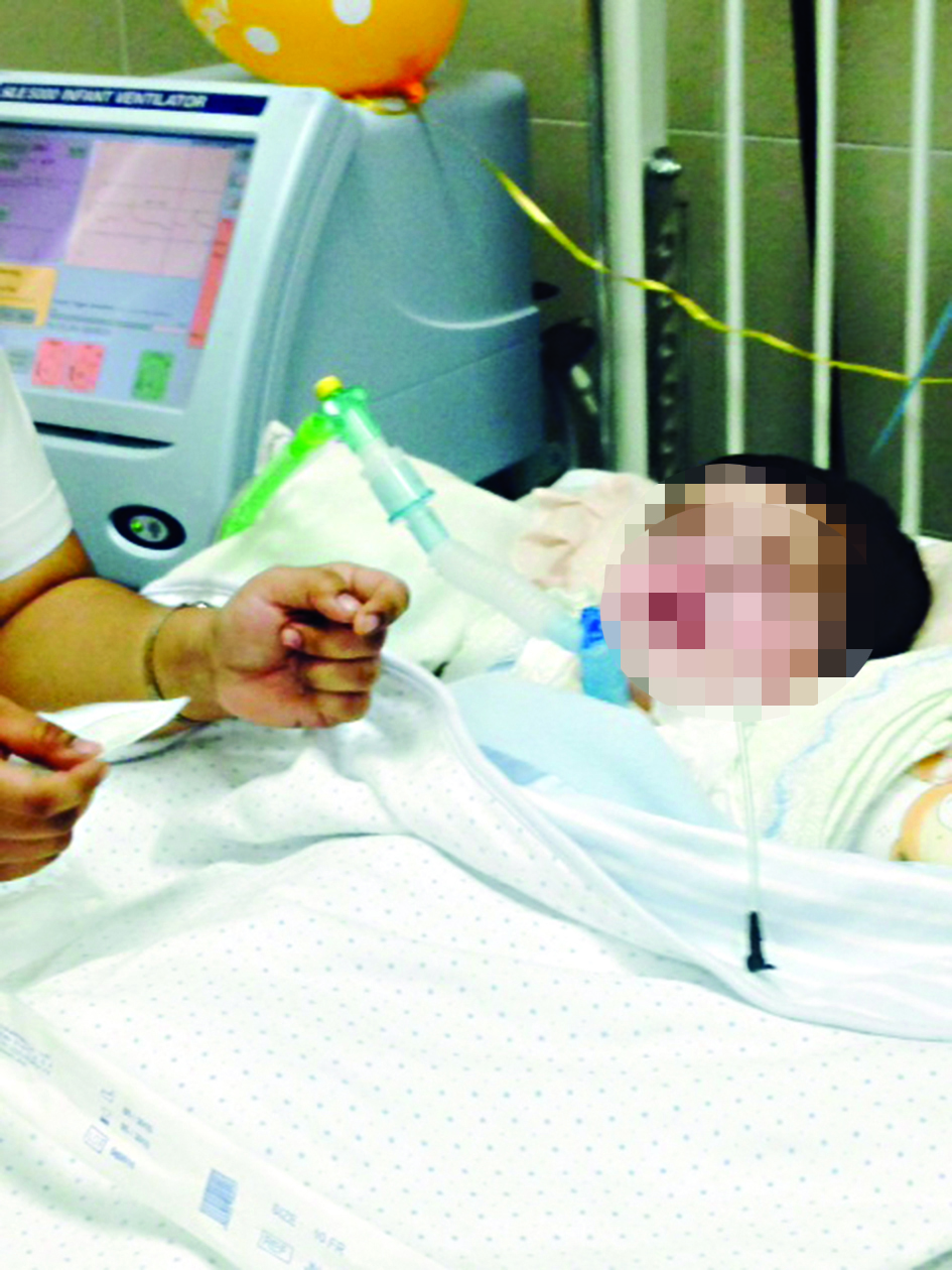 تحقيق المساواة بين الزوجين عند حاجة أبنائهما إلى تدخل جراحي