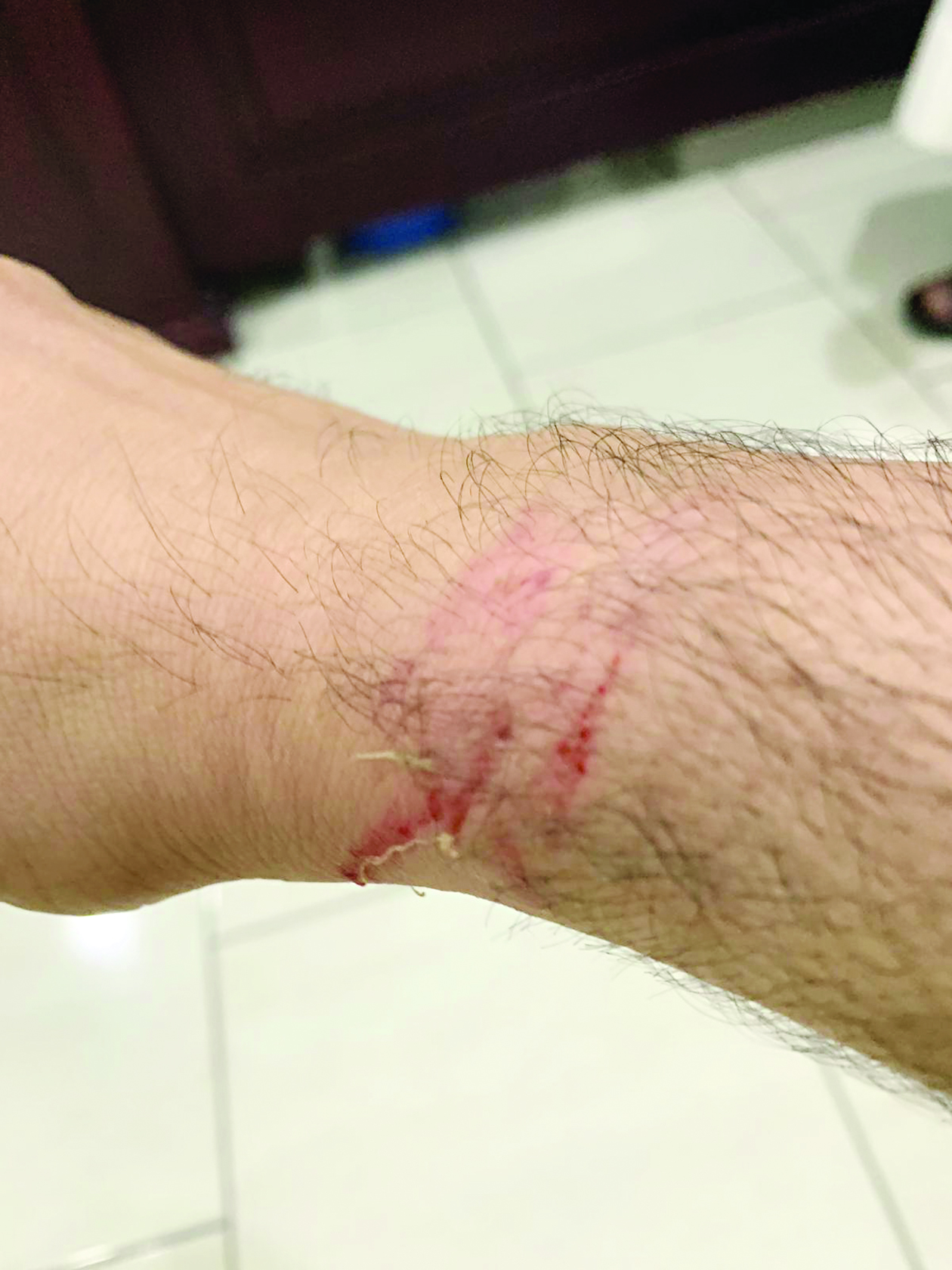 u0623u062bu0631 u0627u0644u0627u0639u062au062fu0627u0621 u0639u0644u0649 u0645u0627u0636u064a u0627u0644u062eu0645u064au0633