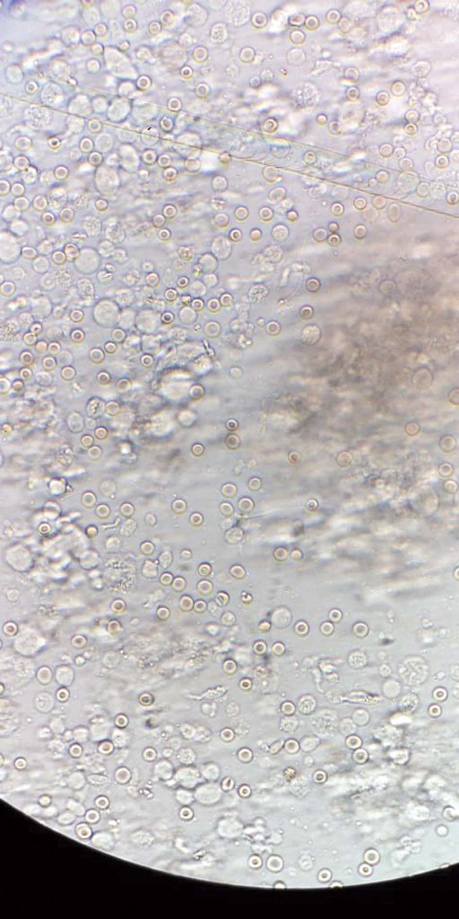 الحيوانات المنوية المستخلصة