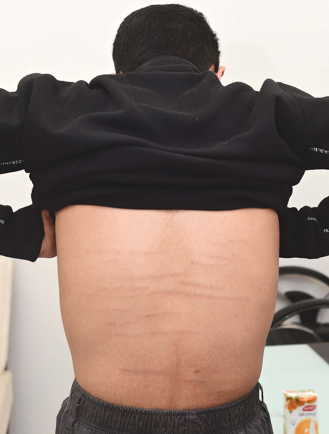 u0622u062bu0627u0631 u0627u0644u0636u0631u0628 u0645u0627u0632u0627u0644u062a u0638u0627u0647u0631u0629 u0639u0644u0649 u062cu0633u062f u0639u0628u062fu0627u0644u0644u0647 u0631u063au0645 u0645u0631u0648u0631 u0646u062du0648 u0633u0646u062au064au0646 u0639u0644u0649 u0627u0644u062du0627u062fu062bu0629