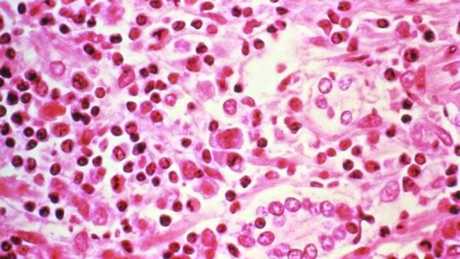 u00abu0647u0627u0646u062au0627u00bb u064au0632u064au062f u0637u064au0646 u00abu0643u0648u0631u0648u0646u0627u00bb u0628u0644u0629