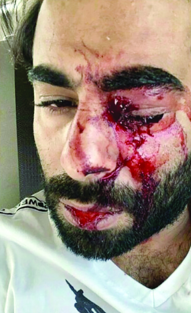 u0627u0644u0635u0648u0631u0629 u0627u0644u062au064a u0646u0634u0631u0647u0627 u00abu0639u0628u0648u062fu0643u0627u00bb u0648u062au0638u0647u0631 u0627u0644u062fu0645u0627u0621 u062au0633u064au0644 u0645u0646 u062cu0641u0646u0647