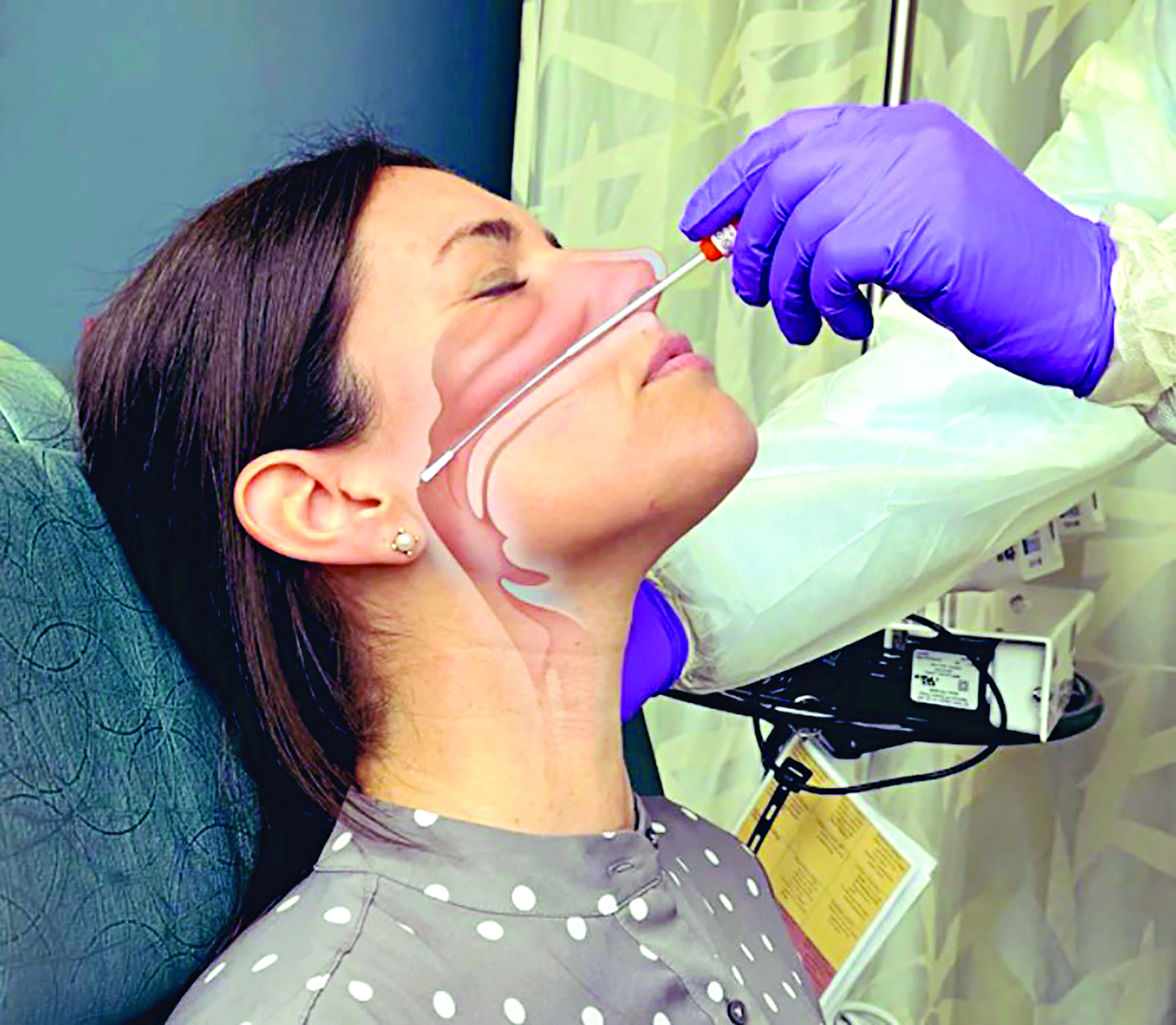 u062au0635u0648u064au0631 u064au0648u0636u062d u0645u0633u0627u0631 u0639u0648u062f u0627u0644u0645u0633u062du0629 u0627u0644u0623u0646u0641u064au0629