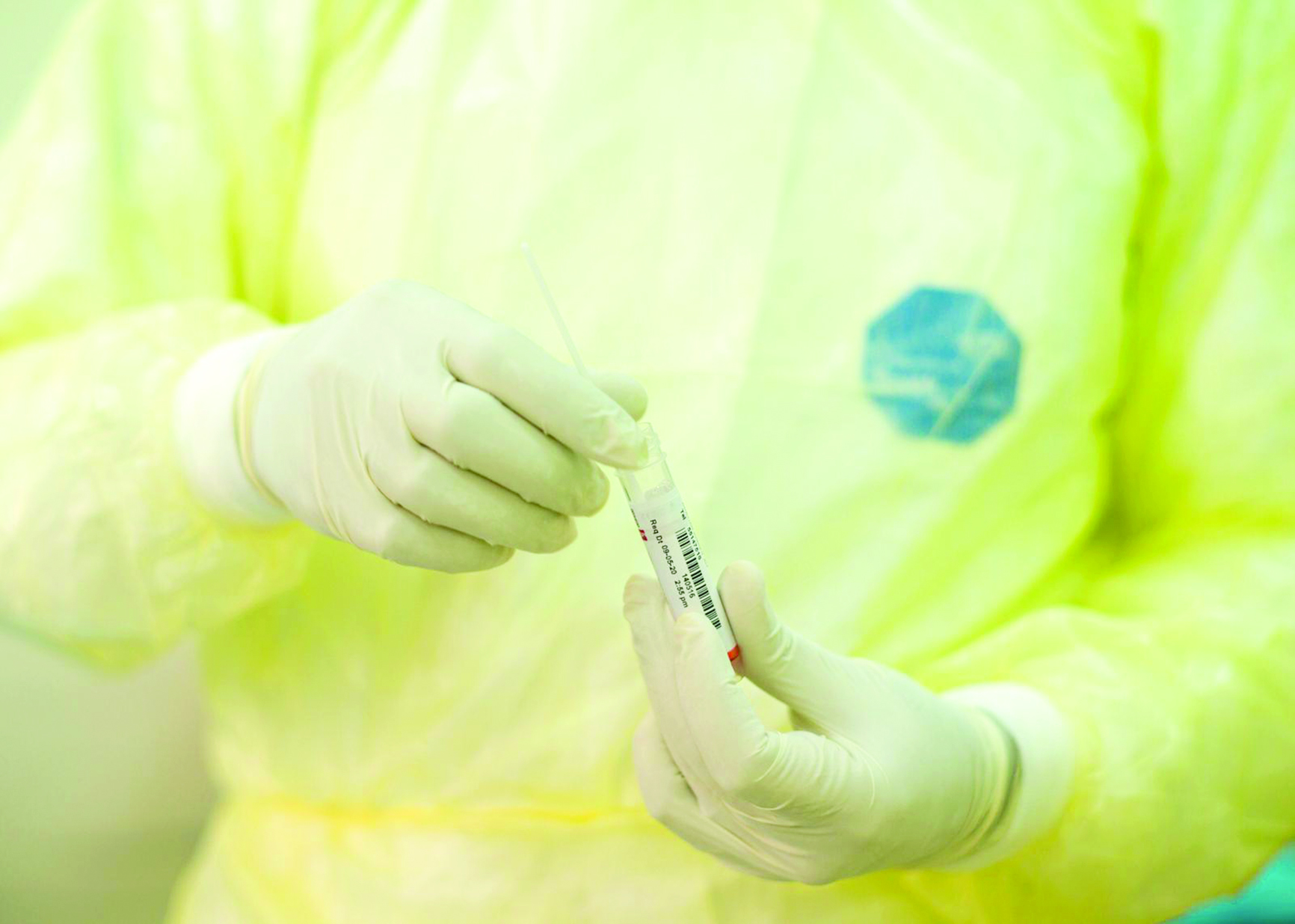 أخذ المسحات