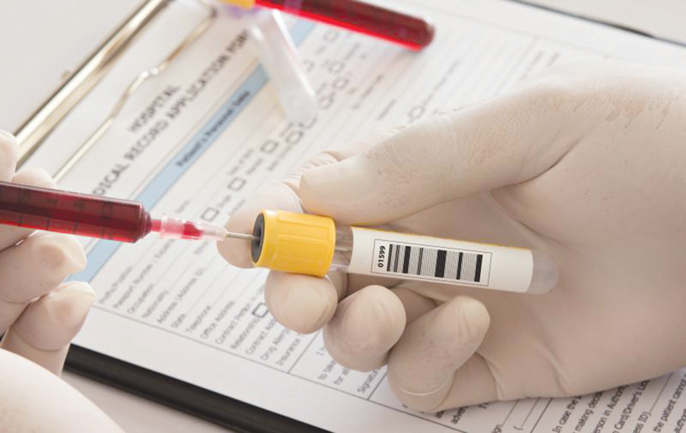 u062cu062fu0644 u0642u0627u0646u0648u0646u064a u0628u0634u0623u0646 u0623u062eu0630 u0627u0644u0639u064au0646u0627u062a u0645u0646 u0627u0644u0645u062au0647u0645