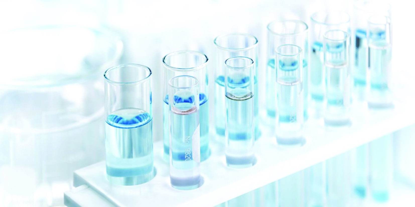 فحص الإصابة بالفيروس سيصبح أكثر سهولة