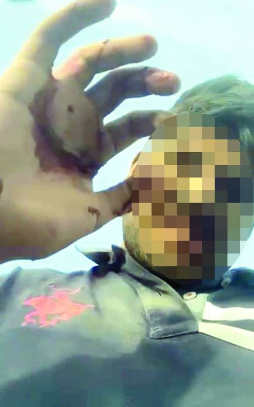 المتعاطي بعد الحادث