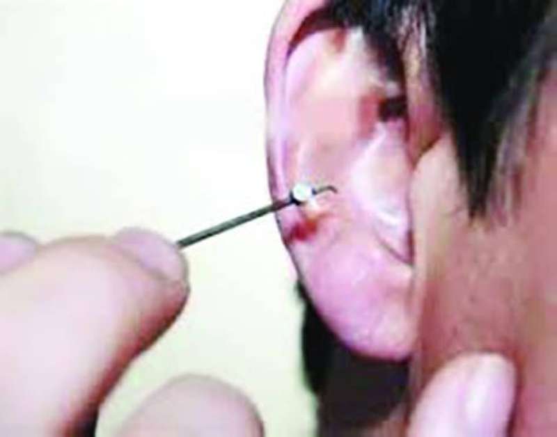 استخراج سماعة من أذن أحد الطلاب