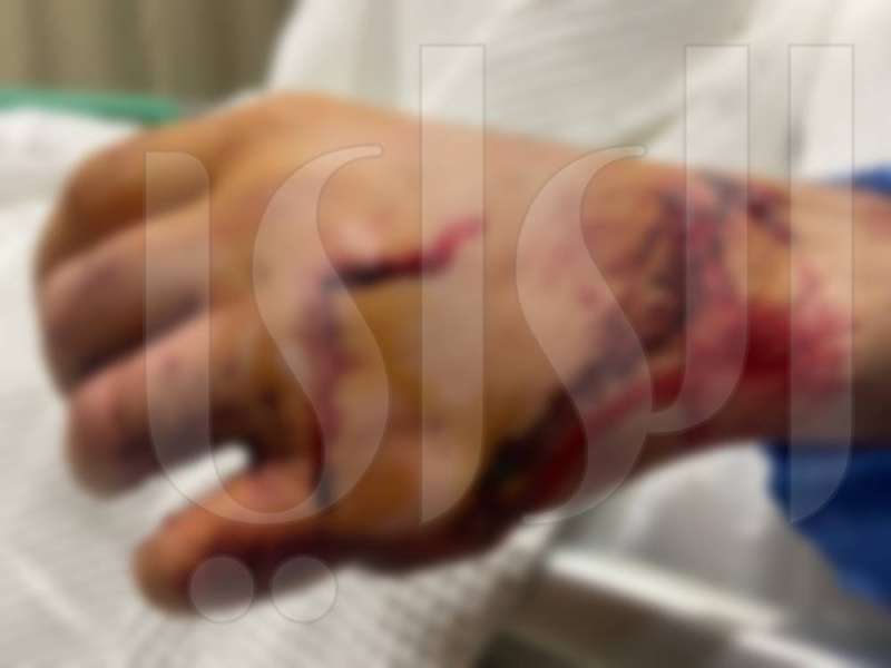  حامد محري البذالي تعرض لإصابات بليغة 