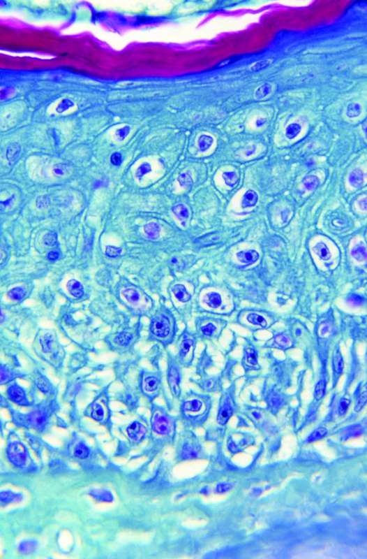 لقطة مُكبّرة تظهر الطفح الجلدي لمرض «جدري القرود» (رويترز)