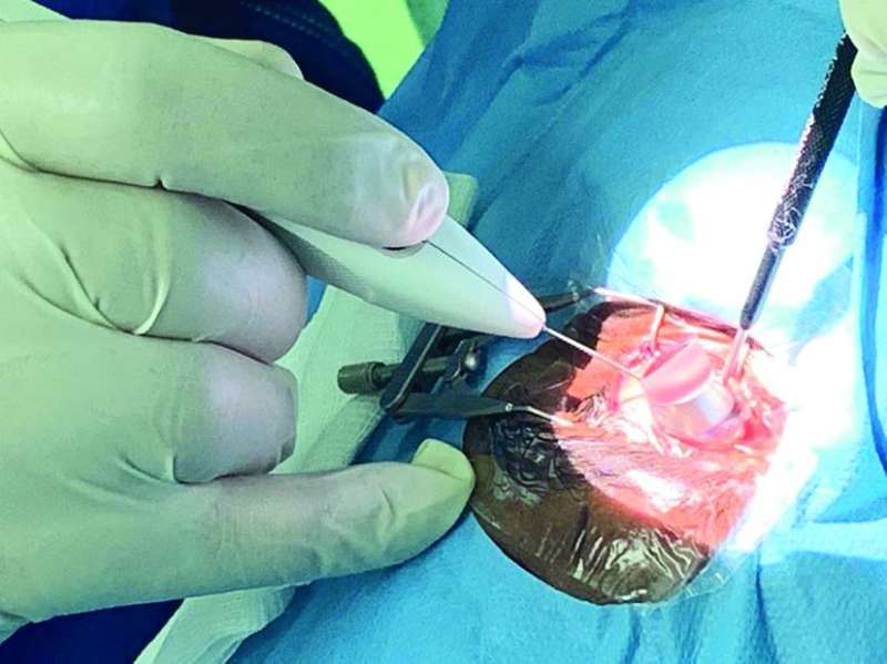 جانب من العملية
