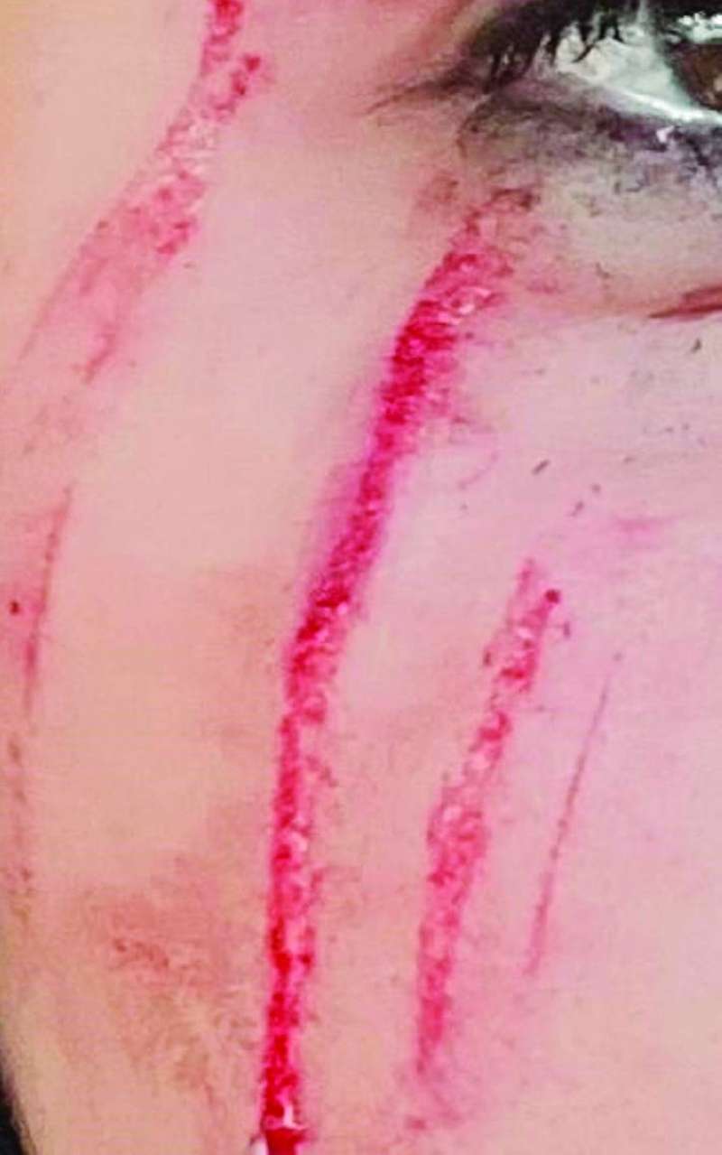 آثار الاعتداء على وجه الضابطة 