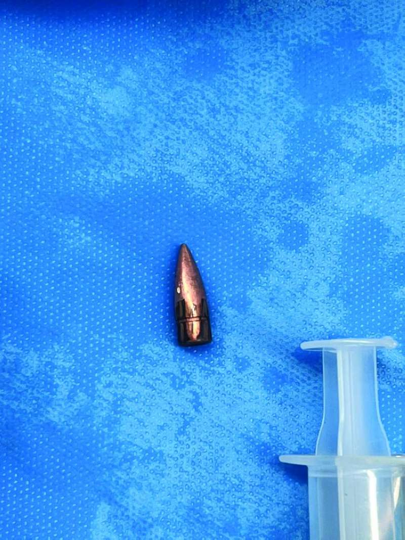 الطلقة تعود لسلاح رشاش 