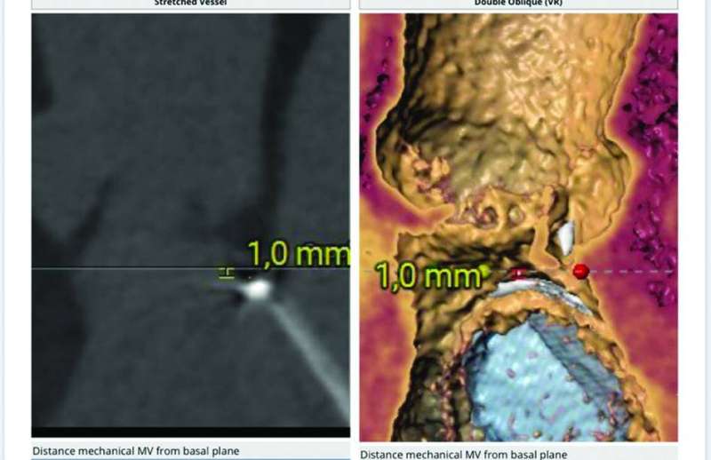 صور توضيحية تبيّن الإنجاز الطبي في الحالة الأولى 