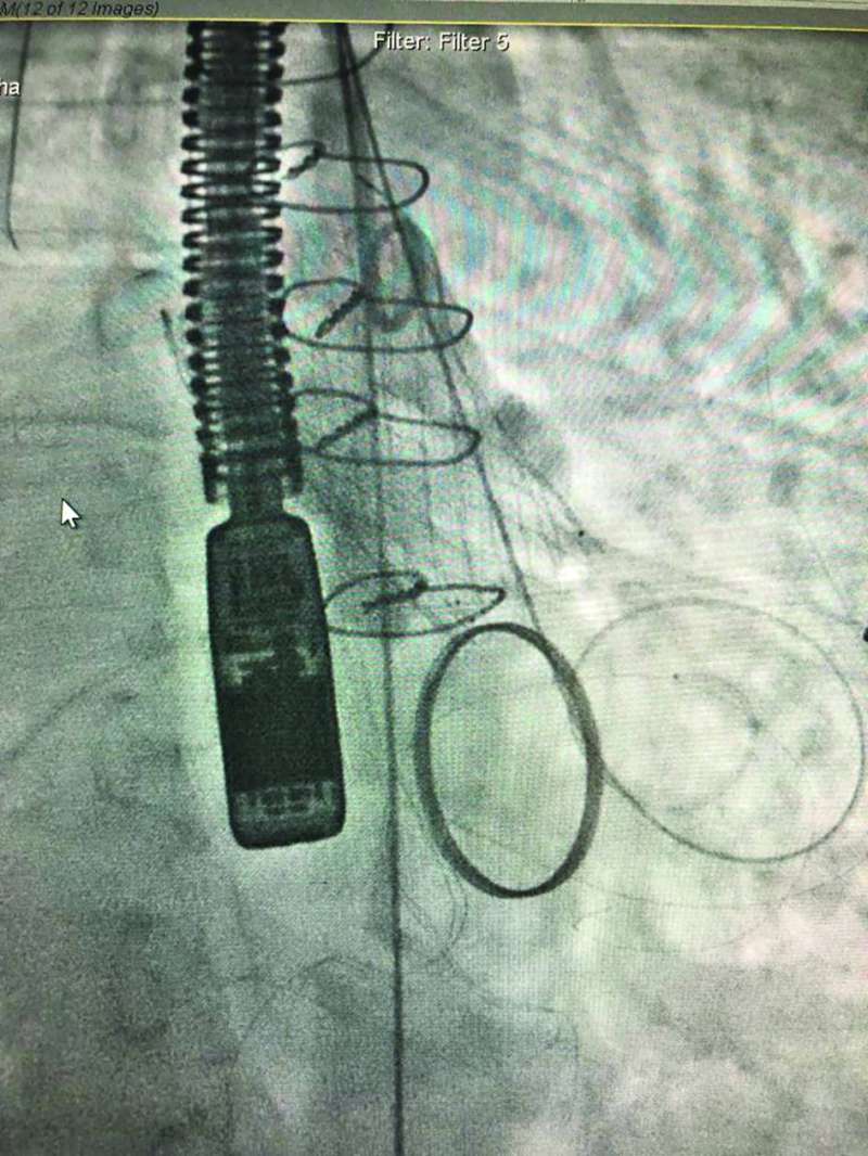 
صور توضيحية تبيّن الإنجاز الطبي في الحالة الأولى