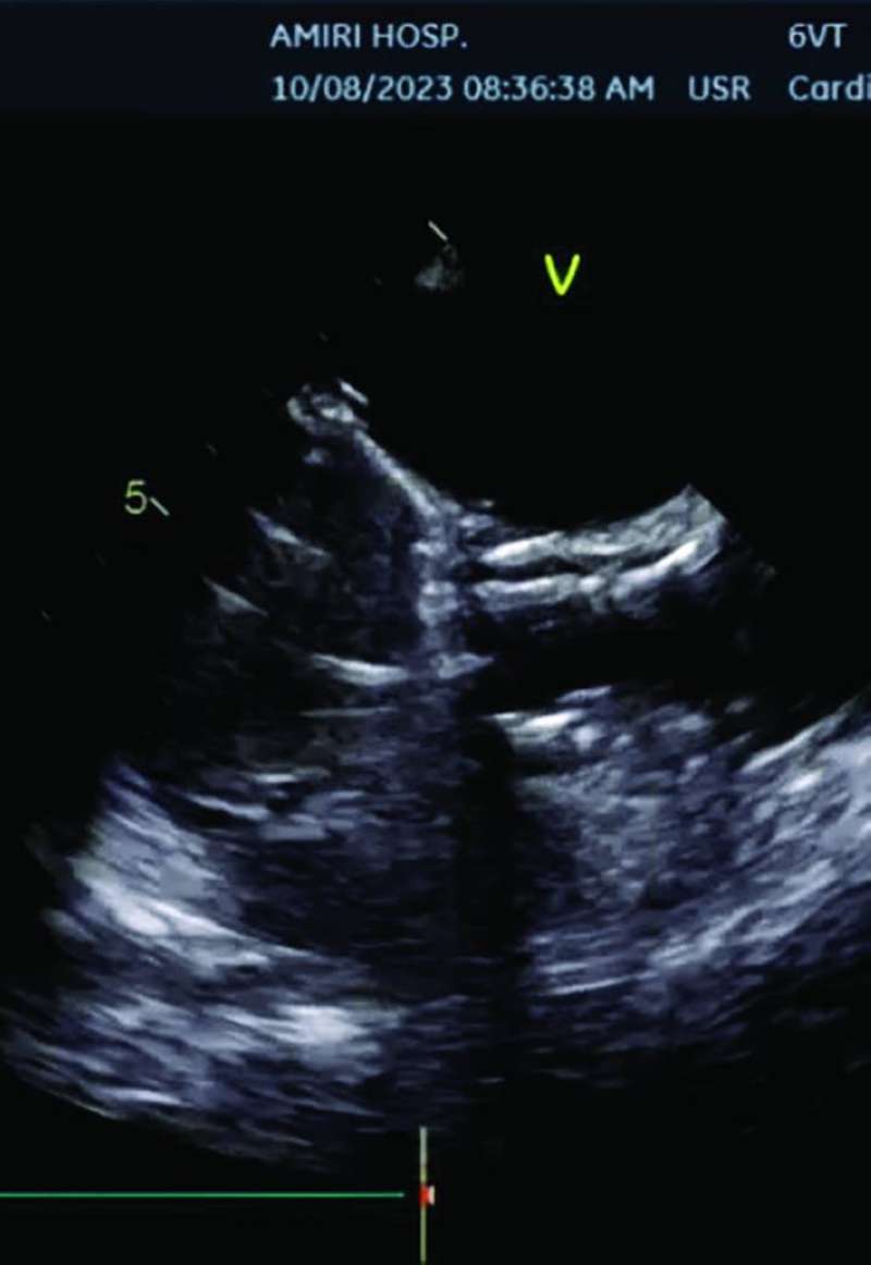 صور توضيحية تبين الإنجاز الطبي في الحالة الأولى