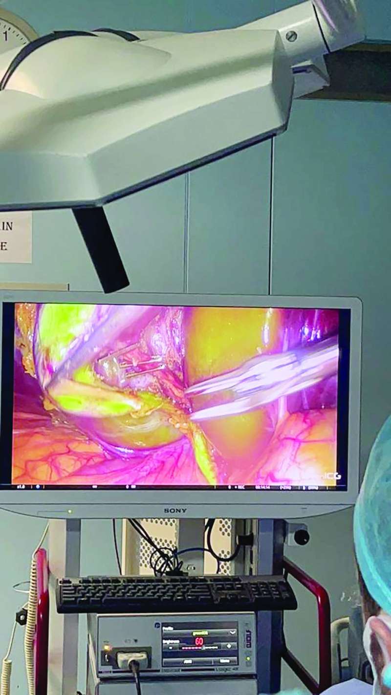 جانب من تقنية التصوير