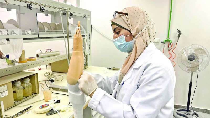 تركيب الاطراف الصناعية - مشروع انساني عظيم تنفذه «النجاة الخيرية»