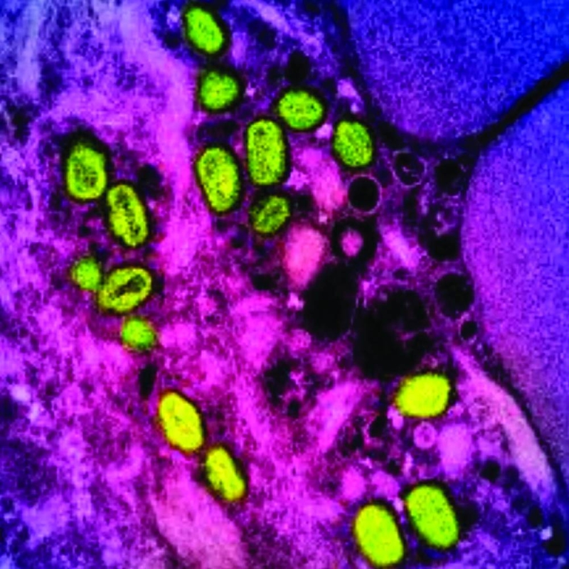 طفح جلدي أحد أعراض مرض «جدري القرود» 