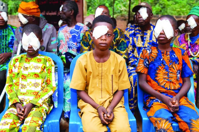 علاج مرضى العيون