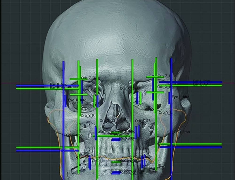 جمجمة القديس نيكولاس ساهمت في الوصول لشكله المحتمل