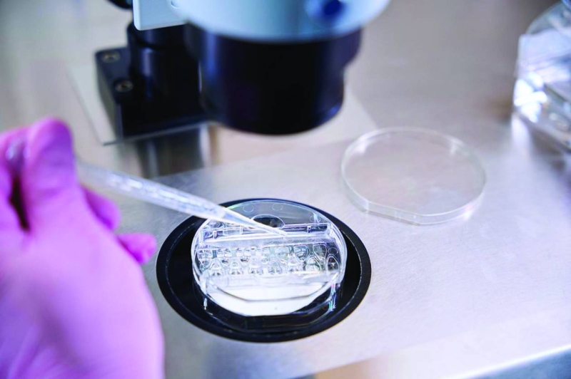 دقة في النتائج 