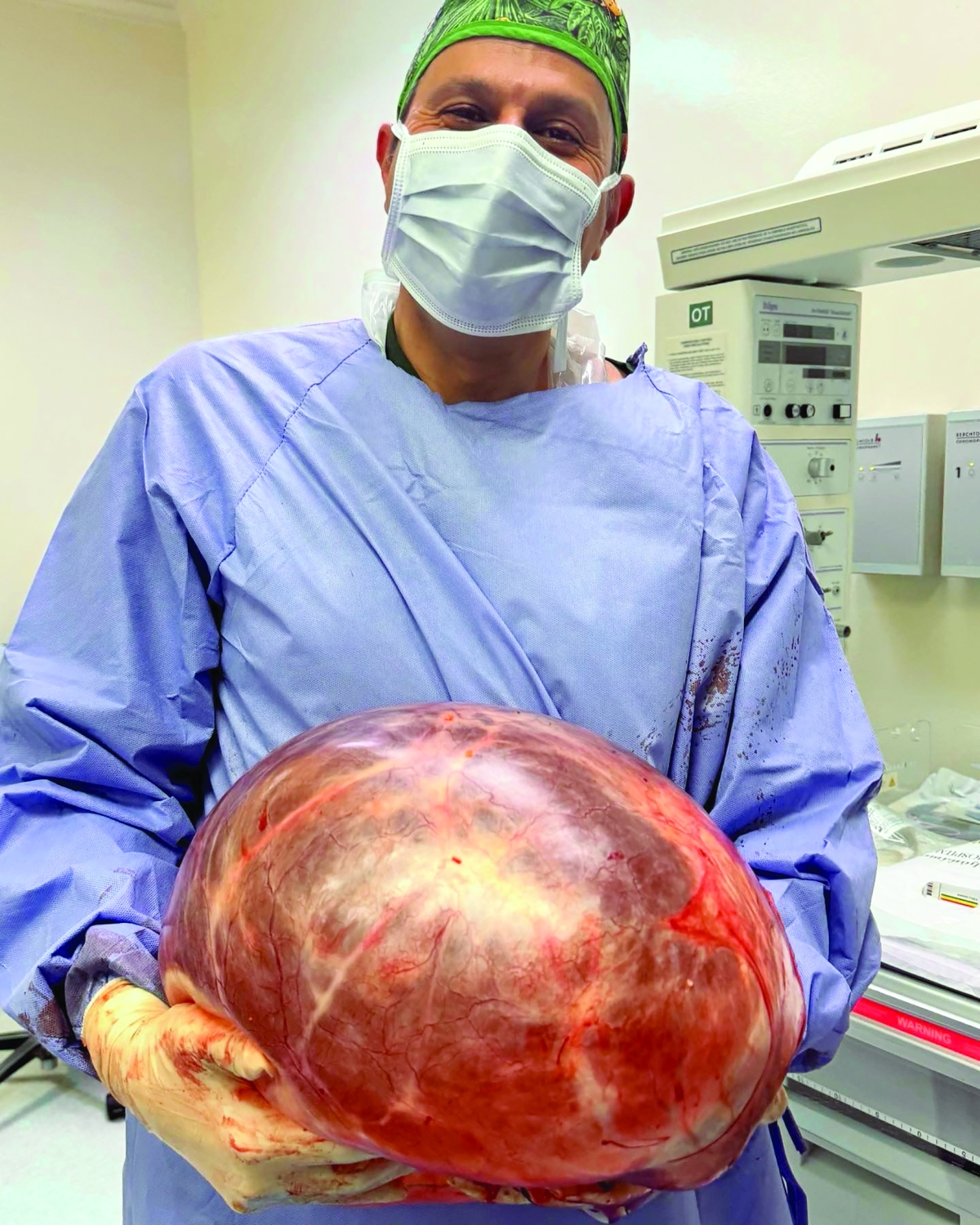 


الجسار يحمل الورم بعد استئصاله 