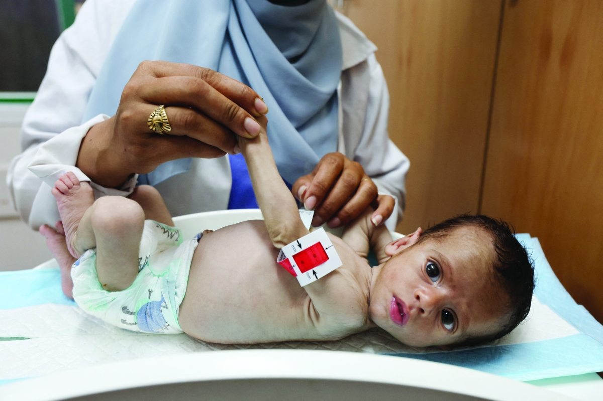 علاج أحد الأطفال من سوء التغذية في مستشفى ناصر في خان يونس (رويترز)