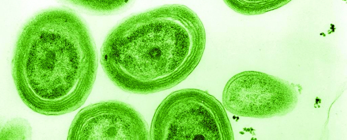 صورة مجهرية لـ Prochlorococcus مع طبقة تلوين خضراء