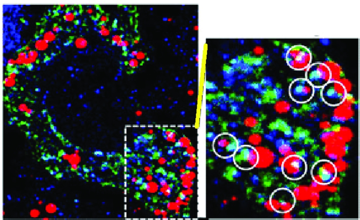 صورة ميكروسكوبية لجزئيات ليبيدات