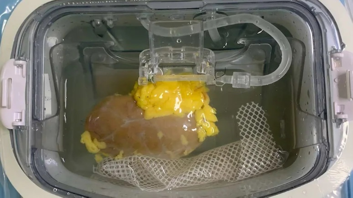 الإنجاز يقلل وقت انتظار الزراعة بنسبة 70 في المئة