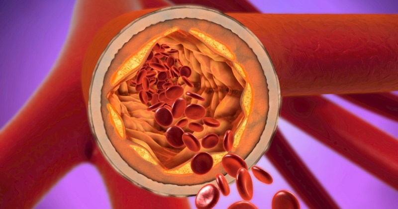 بروتين واحد يتنبأ بأمراض القلب 