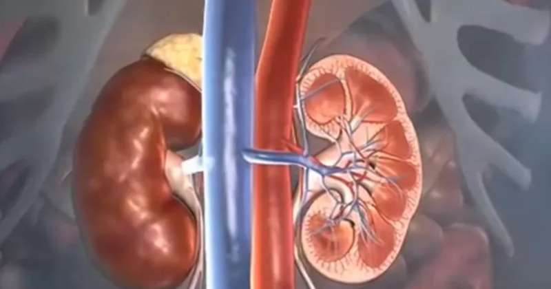 6 خطوات أساسية للحفاظ على صحة الكلى 