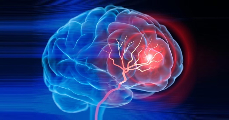 علاج وريدي مبتكر يصلح أضرار الدماغ 