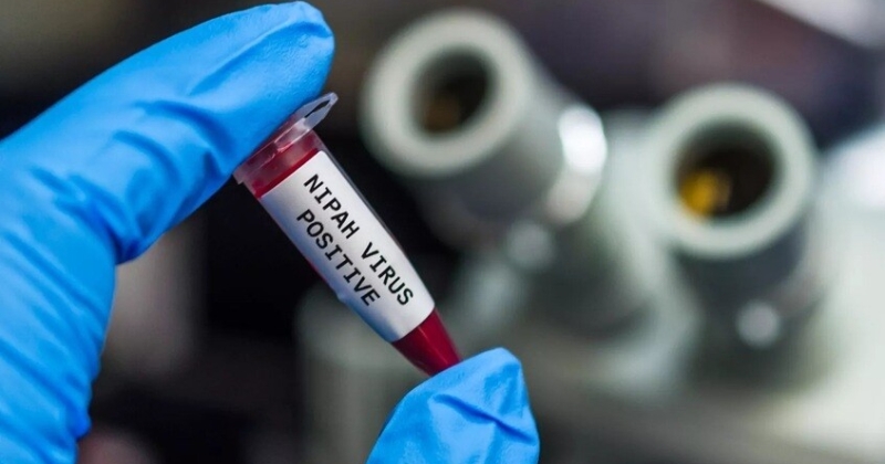 الهند تواجه فيروساً خطيراً. تنقله «الثعالب الطائرة» 