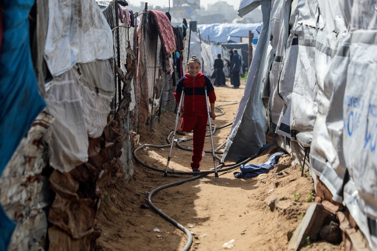 الطفلة الفلسطينية ملاك قادر فقدت ساقها في الغارات الإسرائيلية على مخيم جباليا (شينخوا)